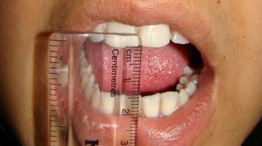 Stres, Kadınlarda &Ccedil;eneyi D&uuml;ş&uuml;r&uuml;yor