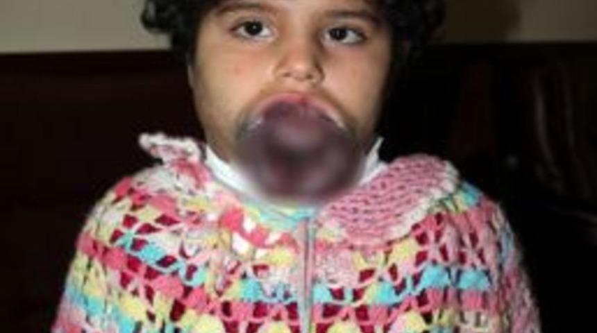 Suriye&rsquo;den Geldi, Kayseri&rsquo;de Şifa Arıyor