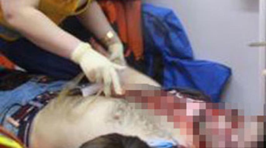 Samsun'da otele kanlı baskın