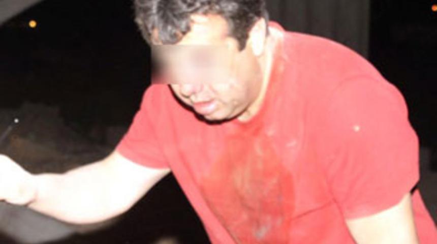 &Ouml;ld&uuml;resiye d&ouml;v&uuml;p yol kenarına attılar