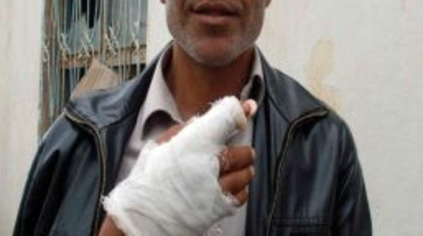 Parmağını Yem Makinesine Kaptırdı