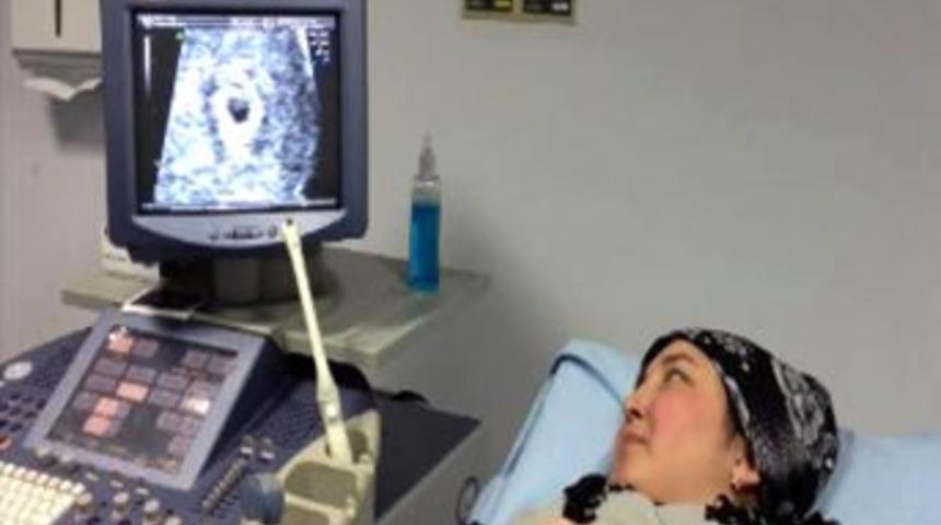 Rahim Nakli Yapılan Derya Sert 6 Haftalık Hamile, Bebeğin Kalp Atışları Izlendi