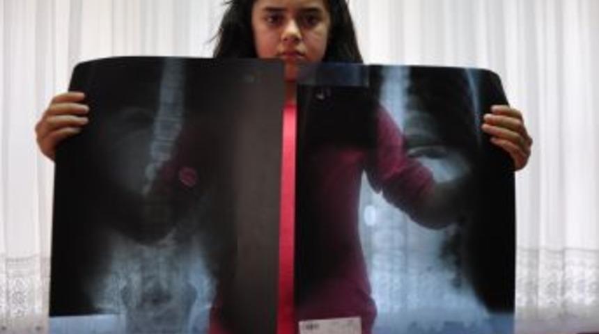 Midesindeki 1 lira ile yaşıyor