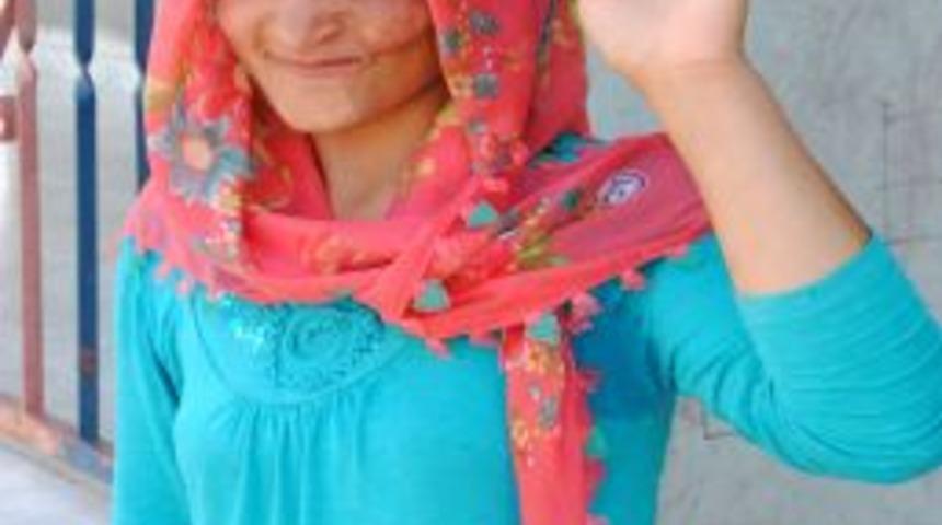 Bir Yaşında Yüzü Yanan Sakine Estetik Ameliyat Için Yardım Bekliyor