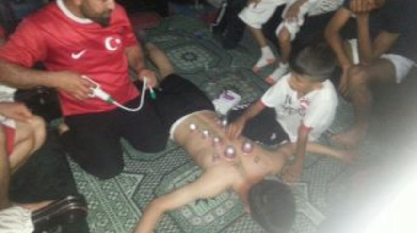 Malatyalı Hokeyciler Hacamat Yaptırdı