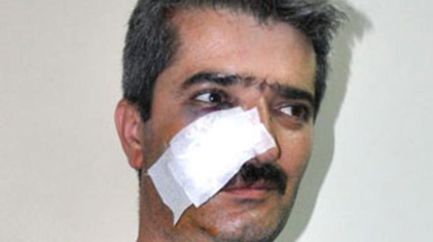 &Ouml;ğrencilerinin g&ouml;z&uuml; &ouml;n&uuml;nde d&ouml;vd&uuml;ler