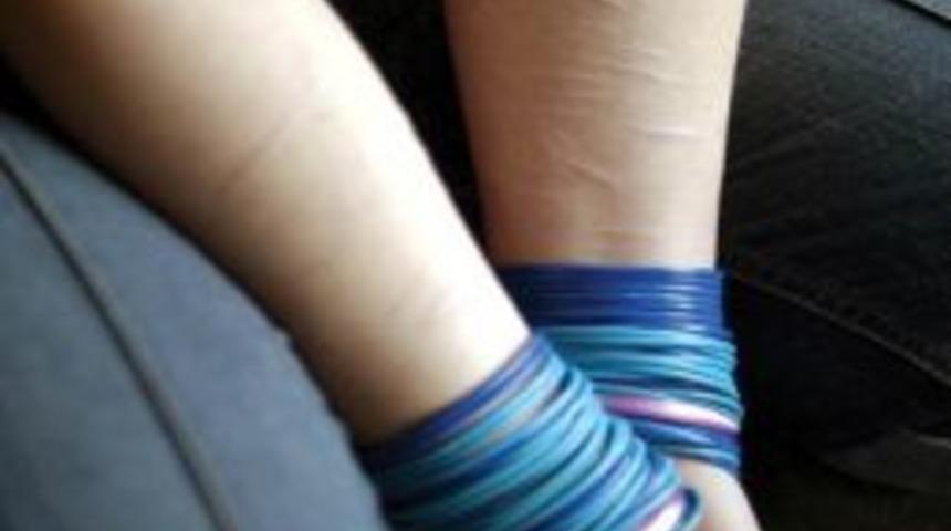 (&ouml;zel Haber) Liseli &Ouml;ğrencinin &Ccedil;alışması &Ouml;nemli Bir Yaraya Parmak Bastı Ve T&uuml;bitak Finalinde Yarışmaya Hak Kazandı