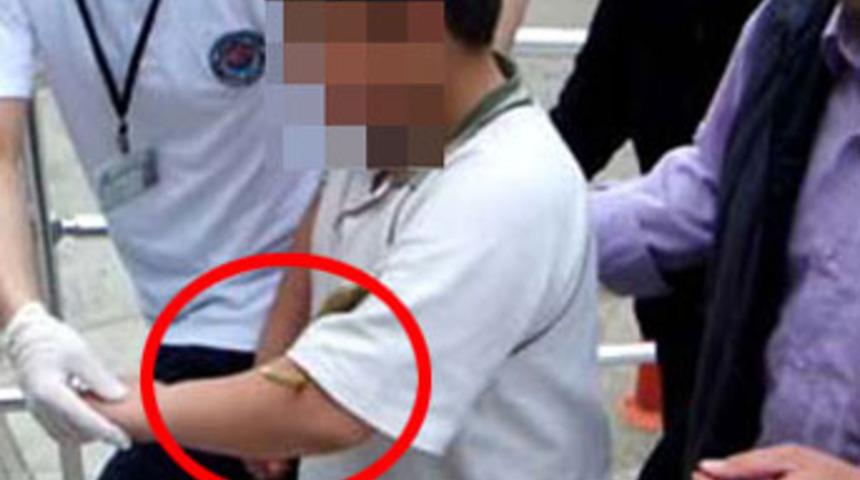 Sınıfın kapı kolu, koluna saplandı