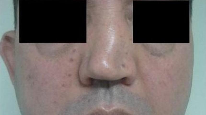 Eğitim Araştırma Hastanesinde Bir İlk