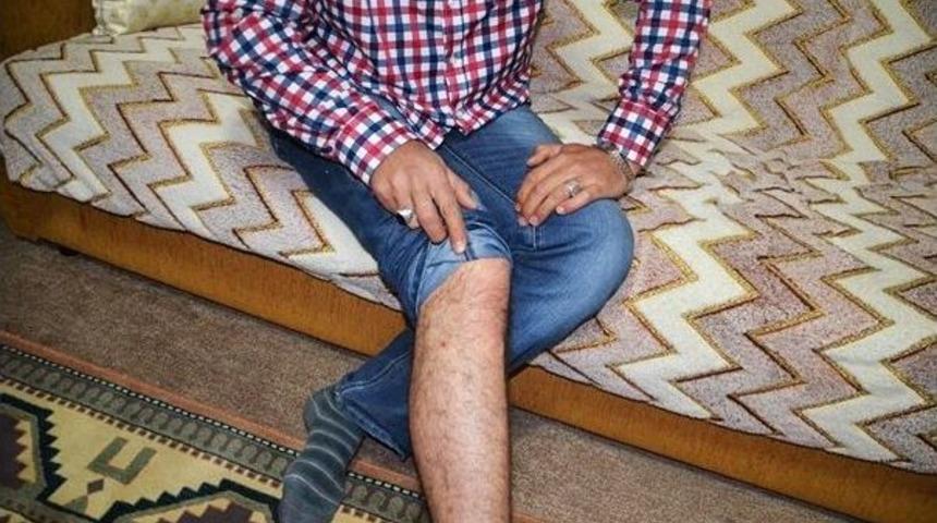 Tosya&rsquo;da Yılın 2. Kene Olayı Yaşandı