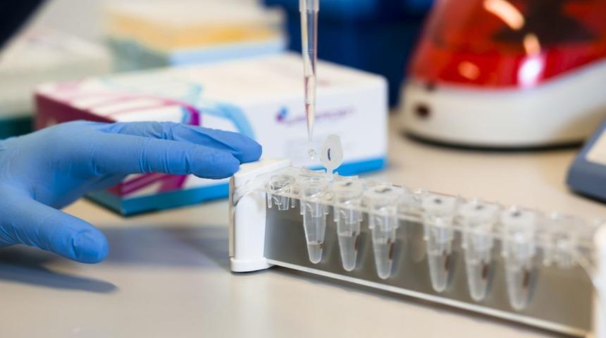 Gen testi ile hastalık eşiğinizi öğrenin! Meğer uzun yaşamanın sırrı bunda gizliymiş!