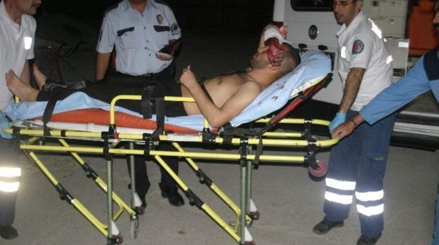 Hırsız, parke taşıyla kırdığı camda kolunu kesti