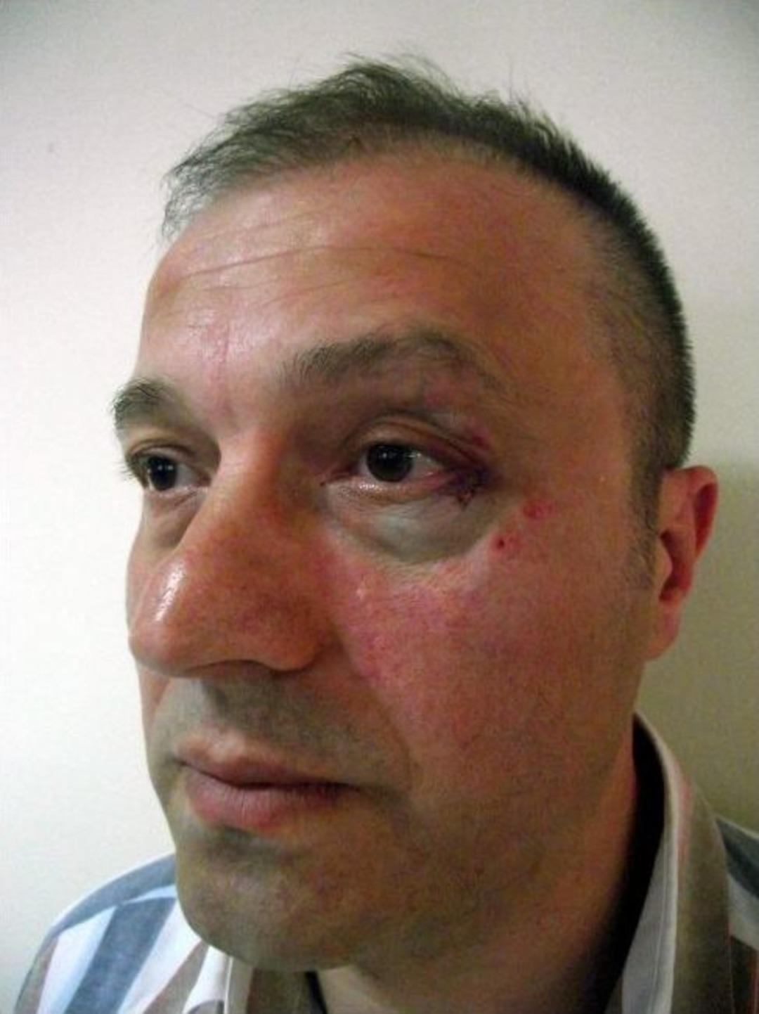 Hasta Yakını, Do&ccedil;enti Darp Etti