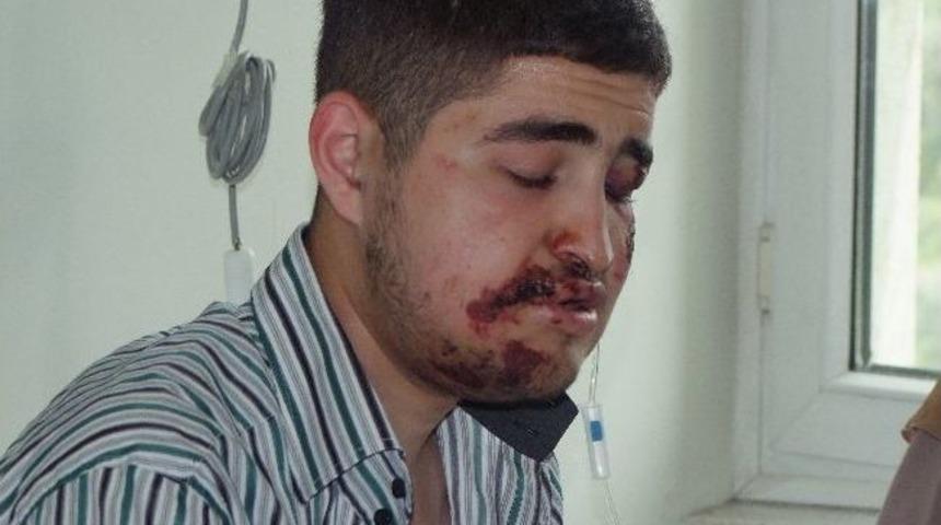 Havaların Isınması İle Motosiklet Kazaları Arttı