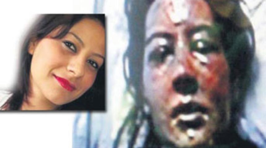 Kıskan&ccedil; koca uykuda haşladı