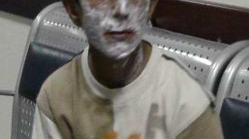 Benzin Bidonunu Ateşe Veren Çocuk Yüzünü Yaktı