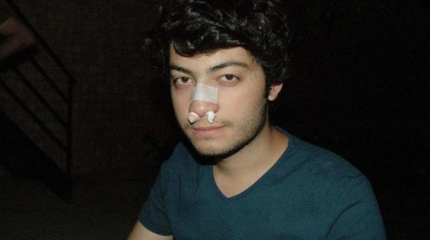 Minib&uuml;s S&uuml;r&uuml;c&uuml;s&uuml; Tıp &Ouml;ğrencisinin Burnunu Kırdı