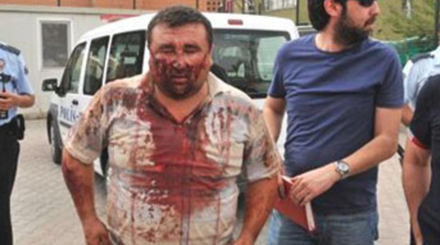 Adana'da madde bağımlısı dehşeti