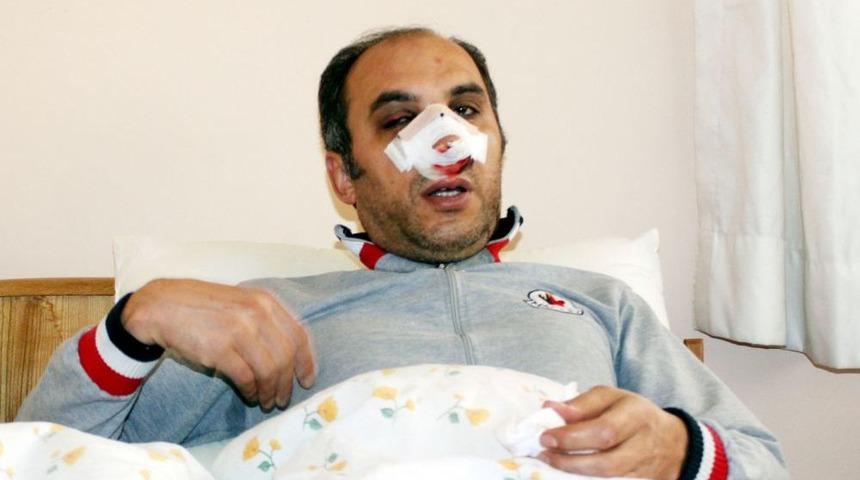 Eylemciler, &lsquo;sivil Polis&rsquo; Diye &Ouml;ğretmeni Hastanelik Etti