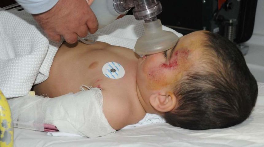 &Uuml;&ccedil;&uuml;nc&uuml; Kattan D&uuml;şerek Ağır Yaralanan Minik Kerem, Yoğun Bakımdan &Ccedil;ıktı