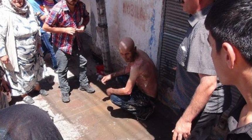 Tiner İle Oynadı V&uuml;cudu Yandı