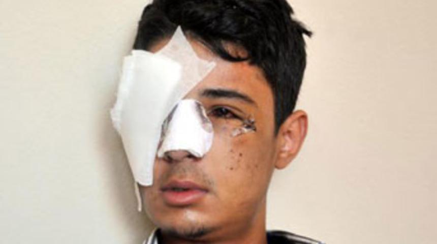 G&ouml;z&uuml;n&uuml; kaybetti, sorumluların bulunmasını istedi