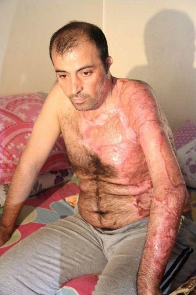 12 Metreden D&uuml;şt&uuml;, Hayatta Kalmayı Başardı 1