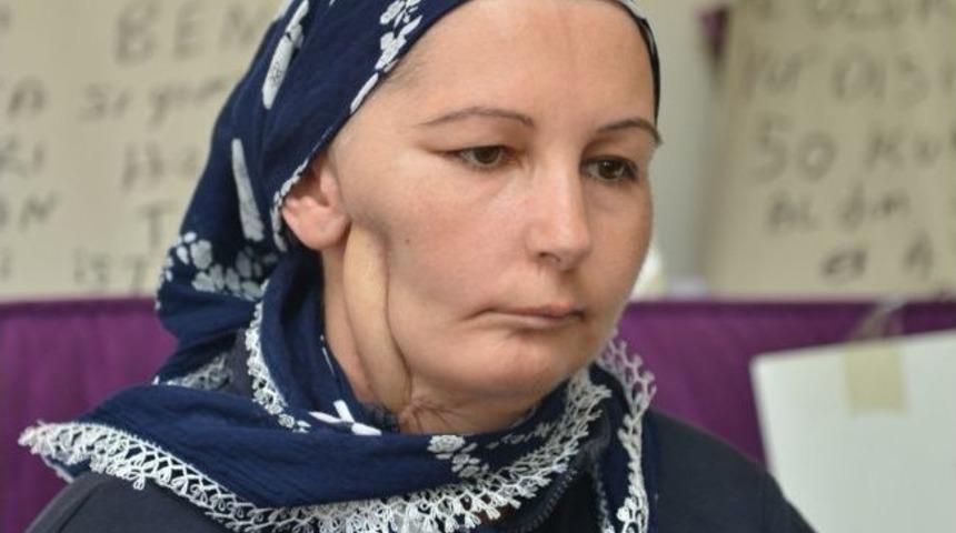 (&ouml;zel Haber) Tedavi Olmak İ&ccedil;in Başbakan'dan Yardım İstedi