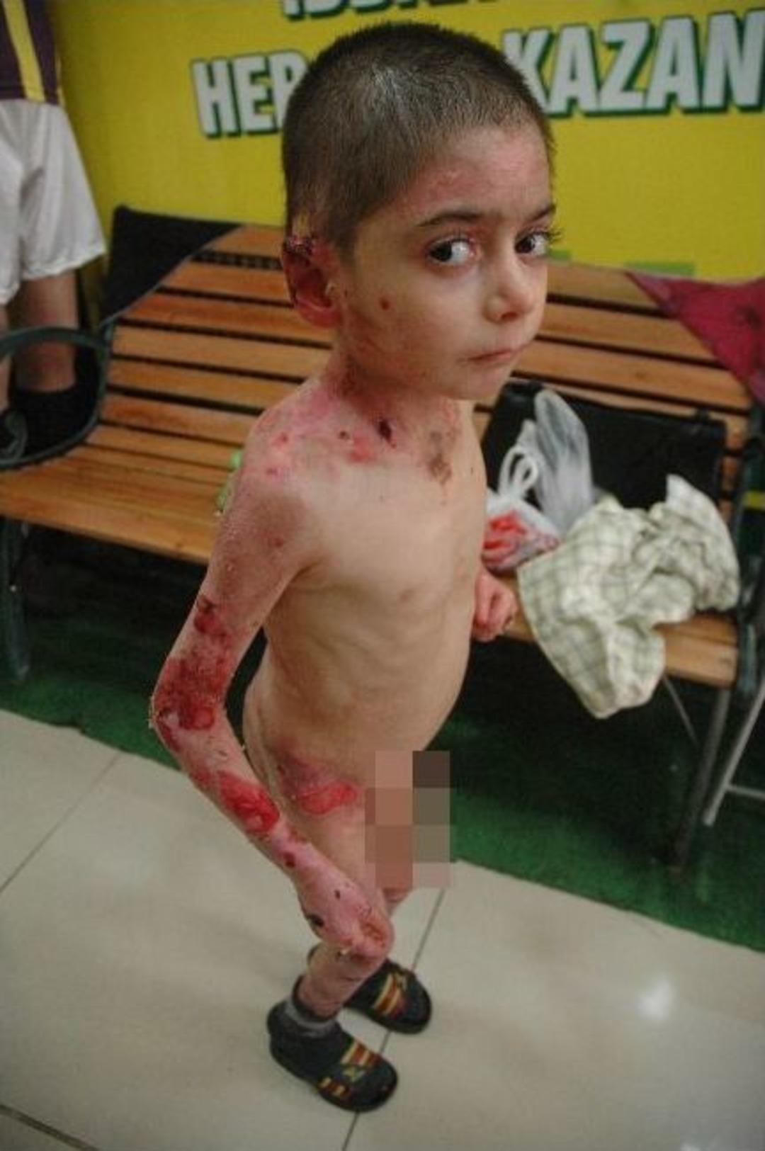 Aydın kardeşlerin her g&uuml;n derileri soyuluyor