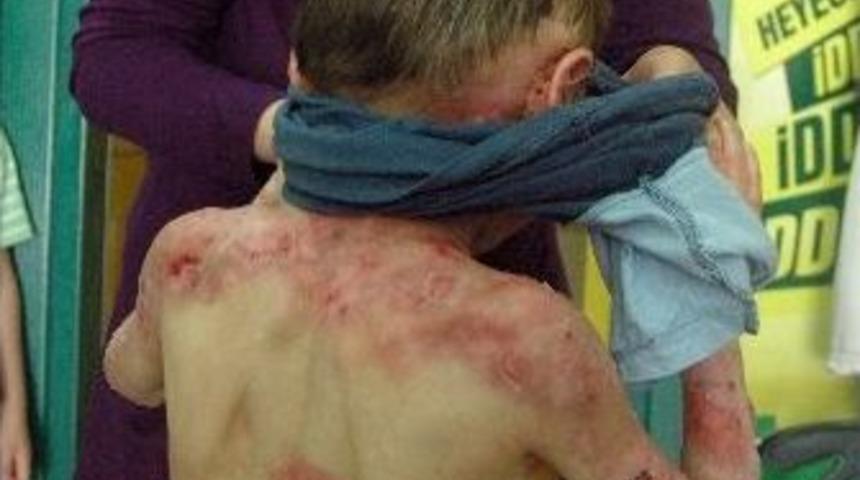 Aydın kardeşlere tedavi yolu g&ouml;r&uuml;nd&uuml;