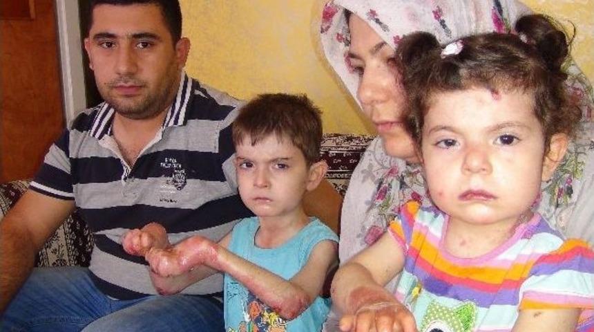 (özel Haber) Deri Dökülmesi Hastalığına Yakalanan Kardeşlerin Ölüm Kalım Savaşı