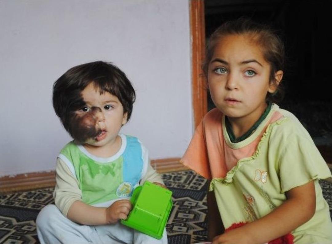 Minik Salih&rsquo;in Y&uuml;rek Burkan Dramı