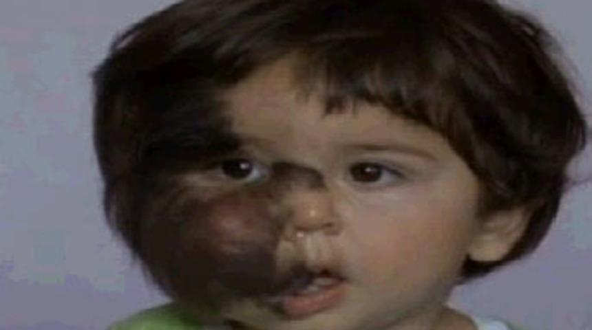 Minik Salih'in y&uuml;rek burkan dramı