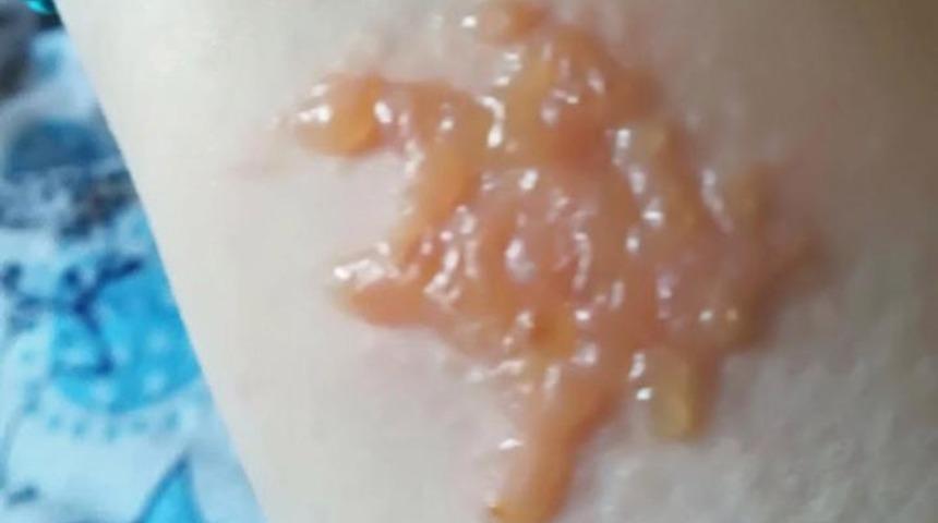 Hint kınası gen&ccedil; kadının hayatını kabusa &ccedil;evirdi