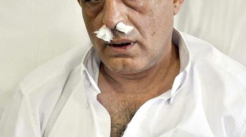 Kastamonu'da 112 Acil Servis Ekibine Saldırı