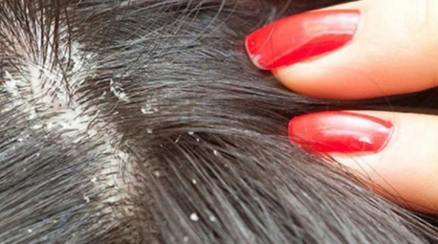 Bit nasıl temizlenir, neden olur?