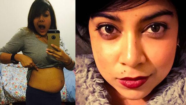 Basit bir bel ağrısı sandı ama hastalığının ölümcül olduğunu öğrendi