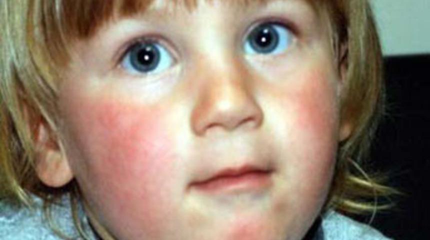 Ameliyatkolik Rıdvan