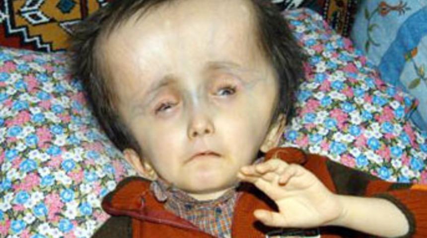 Kafası s&uuml;rekli b&uuml;y&uuml;yor