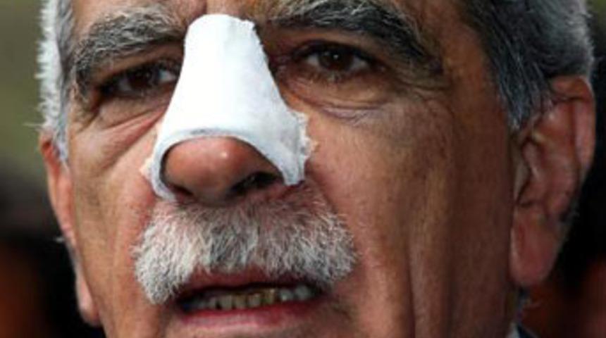 Yumruktan sonra ilk kez konuştu