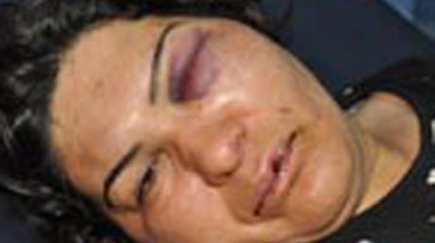 Azerbaycan uyruklu kadına haber dayağı