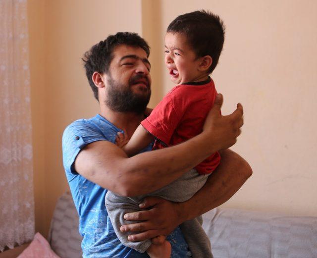 2 yaşındaki Ahmet Muhammed, düdüklü tencereye sıkıştı (3)