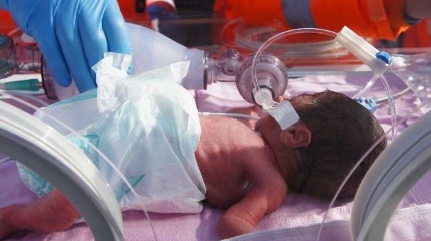 Premat&uuml;re Bebek, Hayata U&ccedil;tu