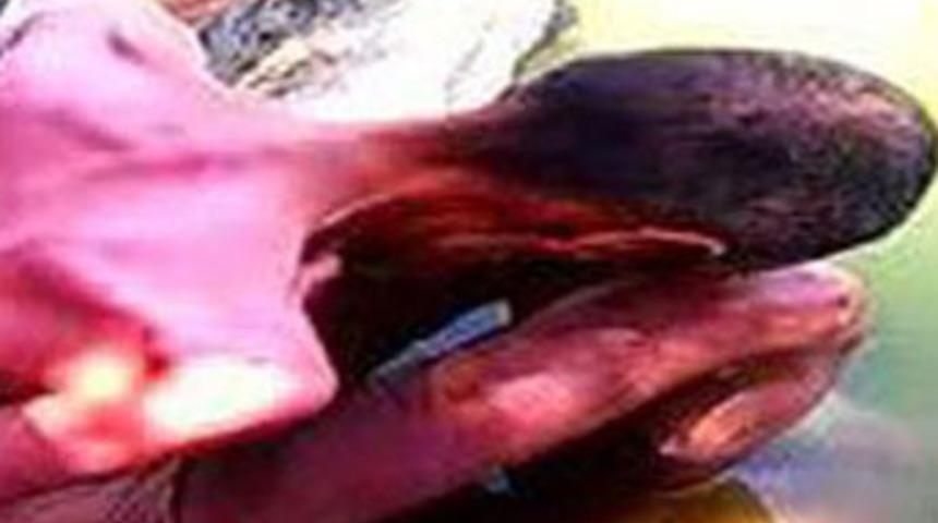 &Ouml;lmek &uuml;zereyken bulundu