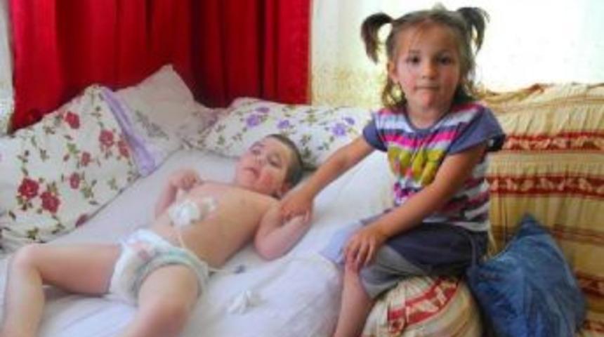 Baldıran otu yatağa mahkum etti