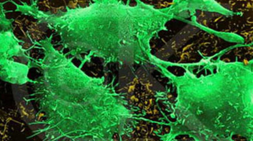 Kanserde erken teşhis