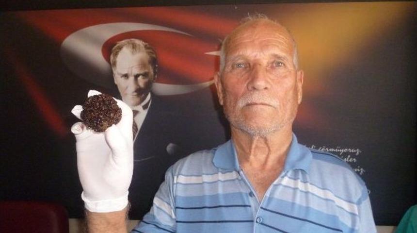 Mesanesinde Portakal B&uuml;y&uuml;kl&uuml;ğ&uuml;nde Taş &Ccedil;ıktı