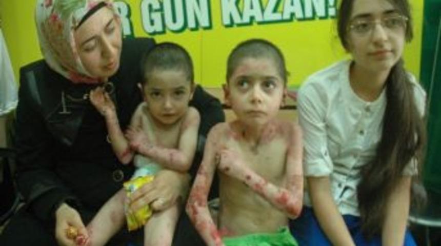 Aydın Kardeşler Taburcu Edildi