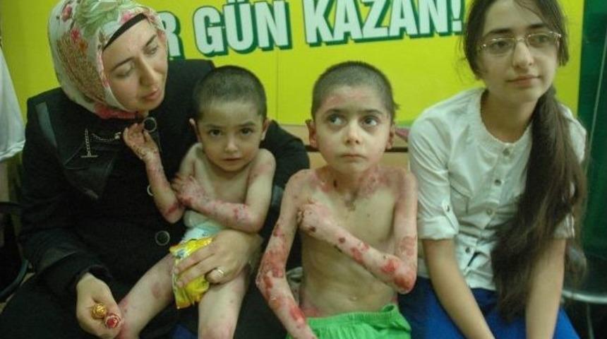 Aydın Kardeşlerin Tedavisi Devam Ediyor