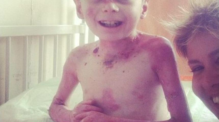 G&uuml;lben Ergen&rsquo;den Cilt Hastası Kardeşlere Ziyaret